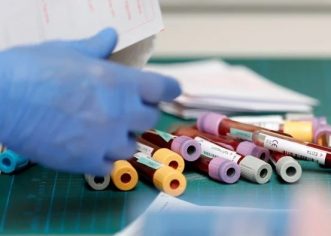 Njemačka počela testirati cjepivo na ljudima