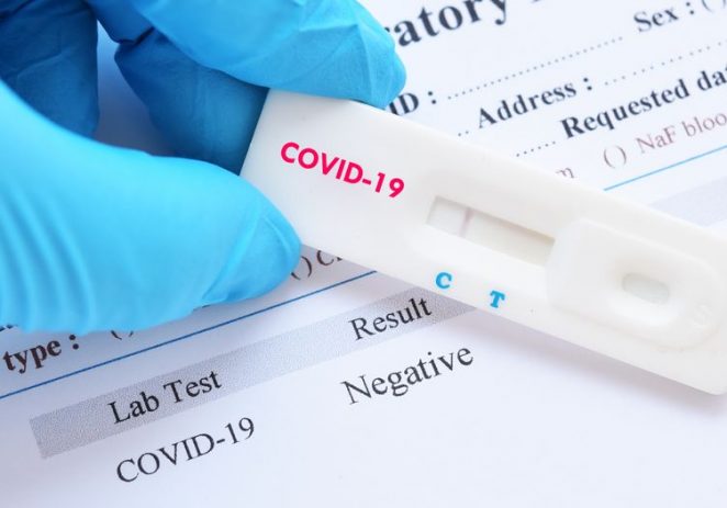 U Istri 8 pozitivnih PCR testova na COVID-19, u proteklih 7 dana incidencija 19,56