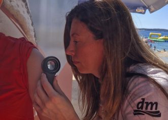 Inicijativa dm-a „Zaštiti se… i uživaj na suncu“ Dermatolozi u Puli pregledali 141 osobu. U Poreču  5. SRPNJA