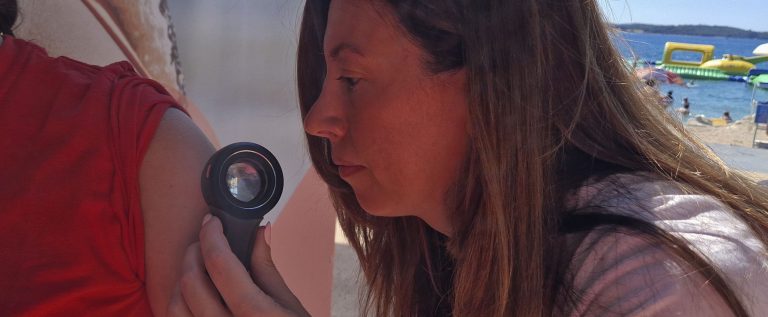 Dermatološki pregled u Puli Dermatološki pregled u Puli